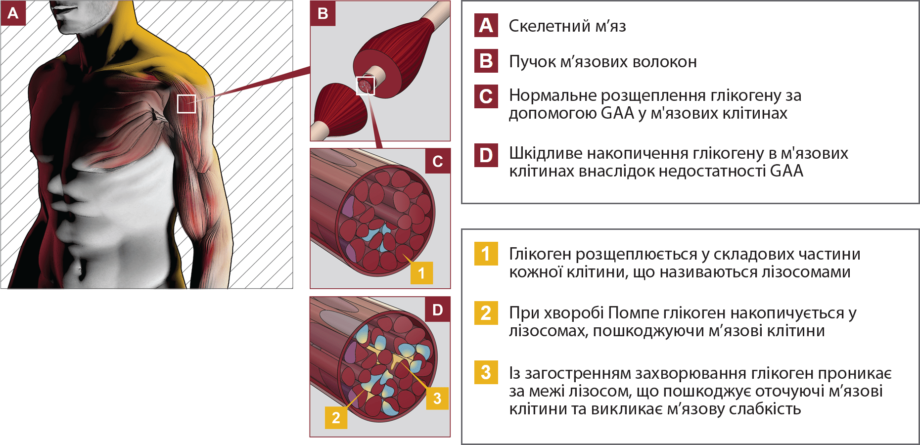 Заболевание мышц лечение